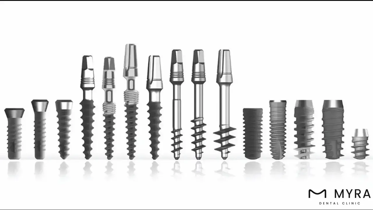 History of dental implants.webp